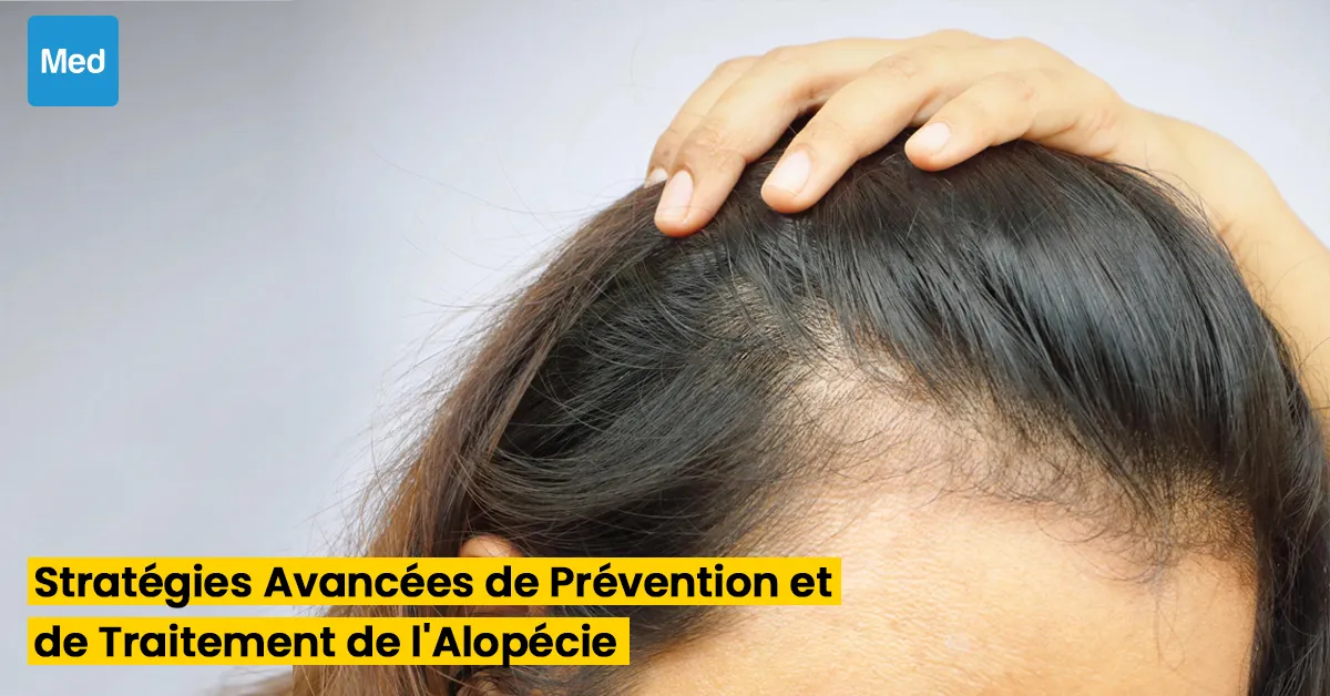 Stratégies Avancées de Prévention et de Traitement de l'Alopécie